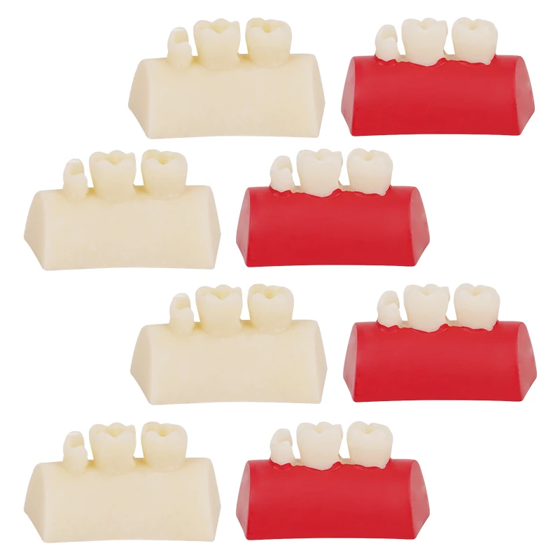 1PC 치과용 인레이 연습 모델 블록 복합 레진 충전 연습 모델 구강 충전 티포돈트 모델 학생 교육용