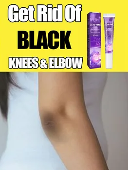 Skin Whitening Cream for Dark Skin Lightening Private Parts Whitening Cream  Arm Thigh Body Knees Whitening Brighten Skin Mild