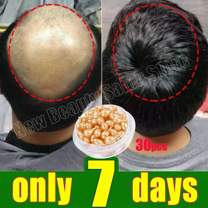 Hair Growth Serum 7 Days Fast Regrowth Essential Capsule Anti Hair loss Baldness Repair Damaged Scalp Treatment for Women Men hair care products