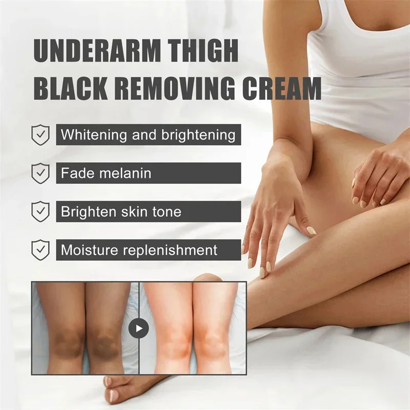 Whitening Cream Private Parts Underarm Bleaching Serum Whiten Butt Knee Brighten Inner Thigh Intimate Parts Dark Remove Melanin whitening cream whitening body cream brightening body cream brightening cream whitening serum