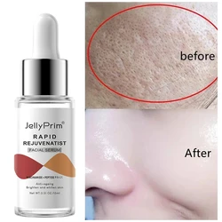 Niacinamide Dark Spot Remover Serum for Face Whitening Moisturizer Hyaluronic Acid Removal Freckle Facial Serum Skin Care 2024