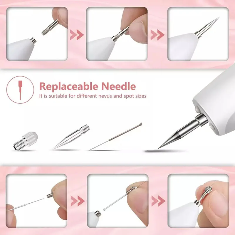 Laser Plasma Pen Skin Tag Remover Freckle Black Dot Papilloma Warts Mole Pimples Tattoo Removal Laser Pen Beauty Care Tools