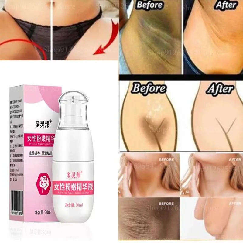 Body Whitening Cream Quick Bleaching Cream for Underarm Knee Buttocks Nipple Private Remove Pigmentation Melanin Brighten Skin