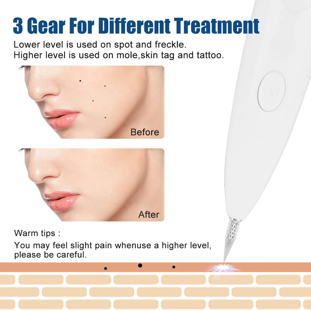 Plasma Pen Freckle Wart Mole Tattoo Skin Tag Black Point Dots Vacuum Spot Remover Machine Skin Care
