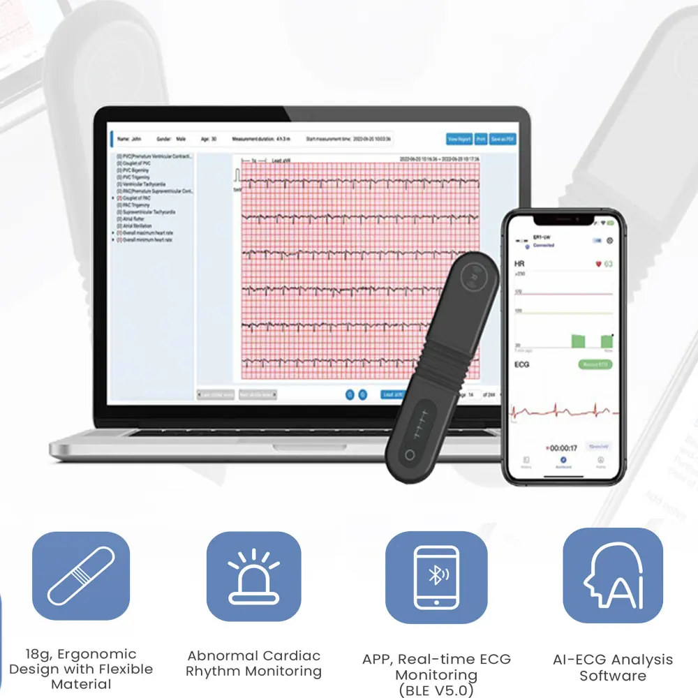 Monitor kesehatan hati AI dapat dipakai Bluetooth pemantau ECG AI Holter AI 24 jam perekam jantung EKG untuk masalah jantung