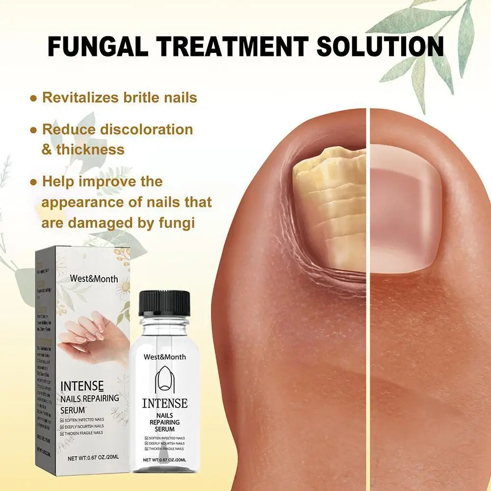 

Nail Fungus Treatment Essence Serum Care Oil Nails fungal Removal Foot Hand Care Gel Anti-Infective And 2023 Repair New X6O0