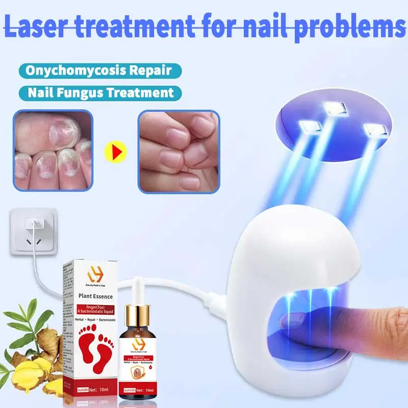 Solving the nail problem