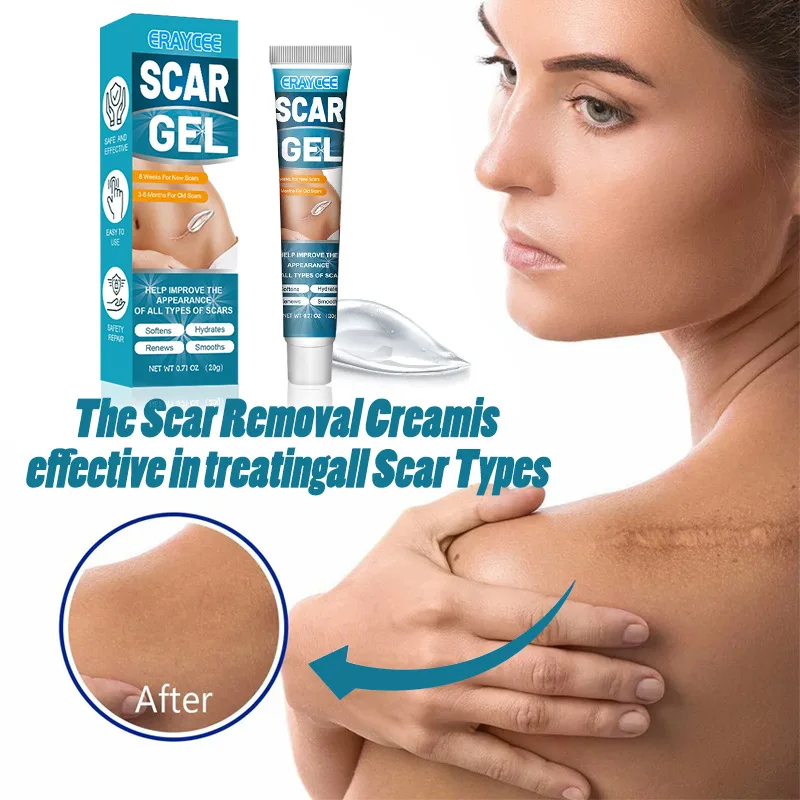 Liquid Bandage Spray ERAYCEE Thin Scar Gel Thin Scar Scald Abdominal Skin Care