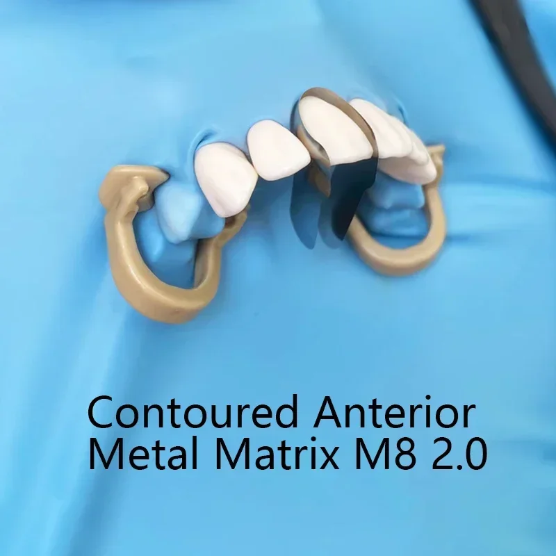 100x Matrices Metálicas Dentales Matrices Contorneadas Seccionales Banda 284953607081
