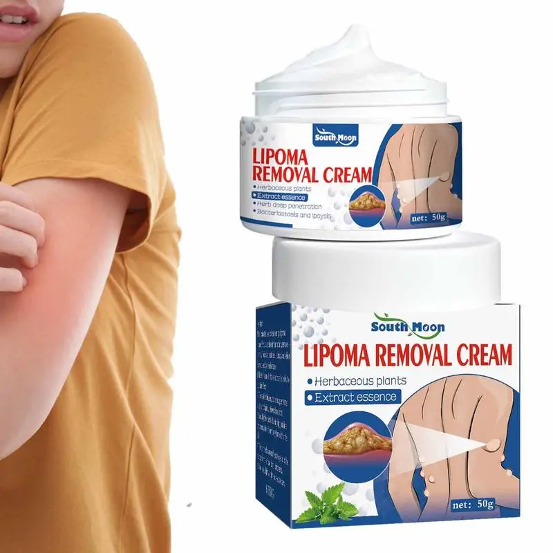 Lipoma Removal Cream The Whole Body Multiple Subcutaneous Conditioning Cream Eliminate Paste Fiber Paste Skin Care 50g