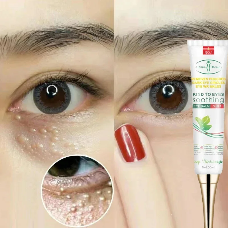 Crème Pour Les Yeux Dissolvant De Granulés De Graisse 7 Sbecd587A167C4066Abe0Ff5382246F4Eh