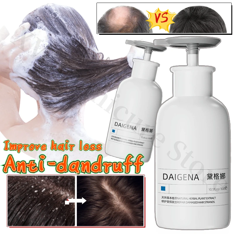

Anti-hair Loss and Oil Control Fluffy Shampoo Improves Frizz Deep Cleans Scalp Repair Damaged Hair Hair Care Shampoo 300ml