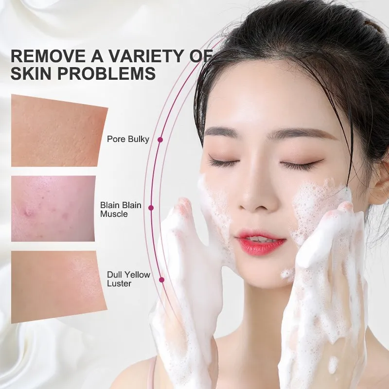 Reinigend Gesiichtscrème Wäissend an Akne Reparatur Haut Ophellend Gesiichtspfleeg Peeling Uelegentfernung Teenager Hautpfleeg Schéinheet_voghion.com