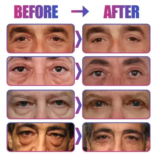 24k Gold Eye Mask Hyaluronic Acid Eye Patch Removal Dark Circles Eye Bags Fishtail Lines Collagen Eye Patch Korean Facial Care 6