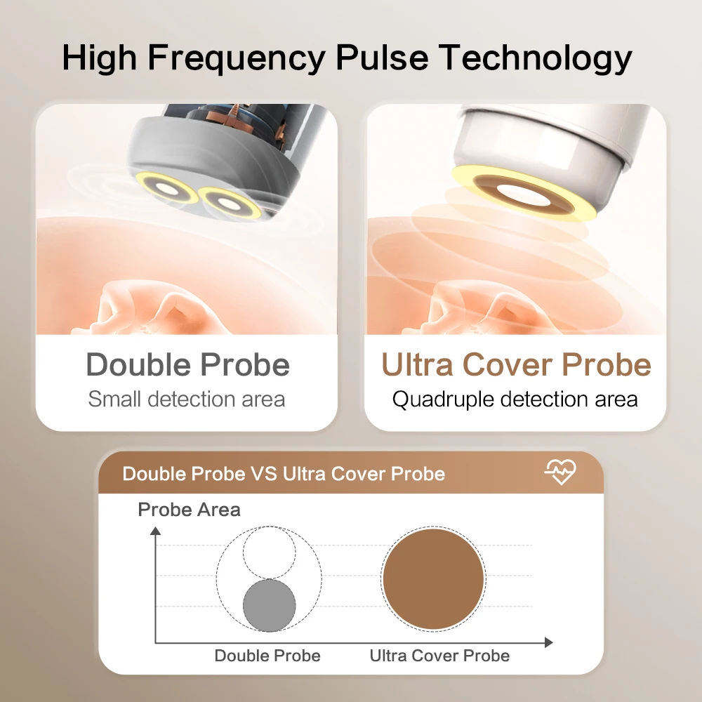 Ultrasound Doppler Fetal 3.0MHz Fetal Doppler Baby Sound Angelsound Monitor DSP Technology Pregnant Baby Heartbeat Data fetal heart rate monitor