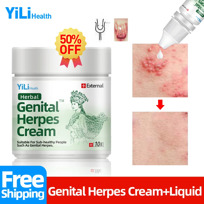 Male Genital Herpes Outbreak Treatment Herbal Cream For Anti Herpes