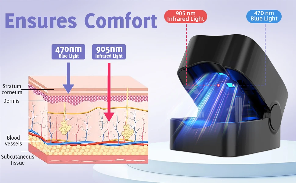 Nail Laser Led Light Device For Fungus And Discoloured Nails_voghion.com