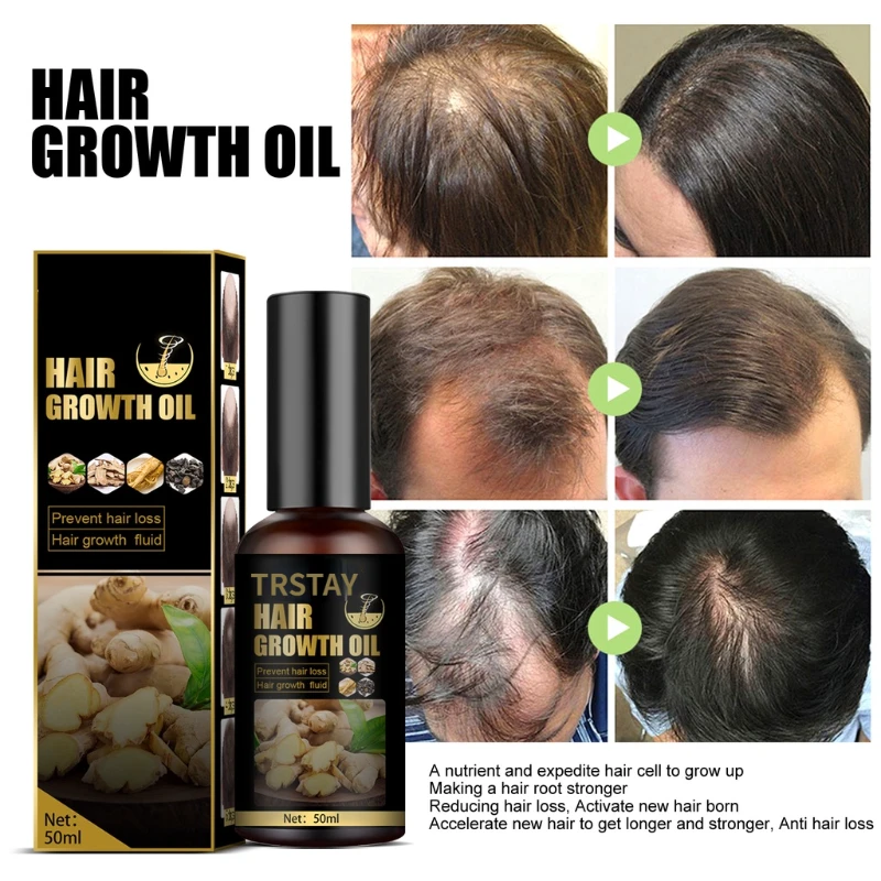 Hair Growth Ginger Oil Hair Treatment Spray Serum Hair Grower Care Anti Hair  Loss For Men And Women Beauty Products - Hair Loss Product Series -  AliExpress