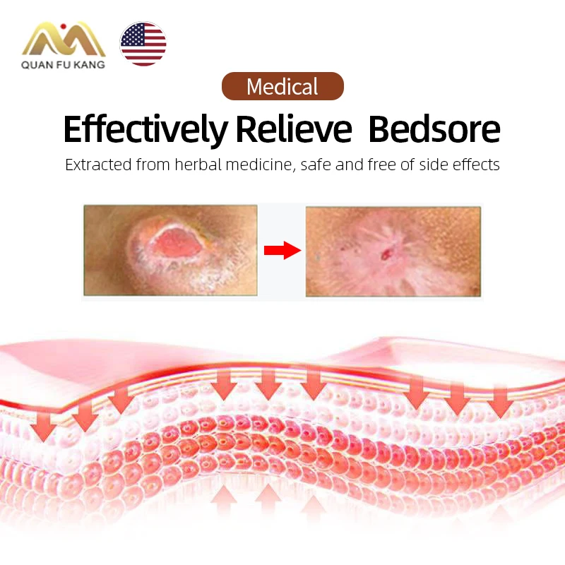 https://ae01.alicdn.com/kf/Sbf1d2ff0bfe343d4b46d0d7e7cf0ccaaX/American-Bedsores-Wound-Healing-Pressure-Ulcer-Treatment-Herbal-Cream-Removal-Rot-Myogenic-Ointment-Anti-Skin-Bedsore.jpg