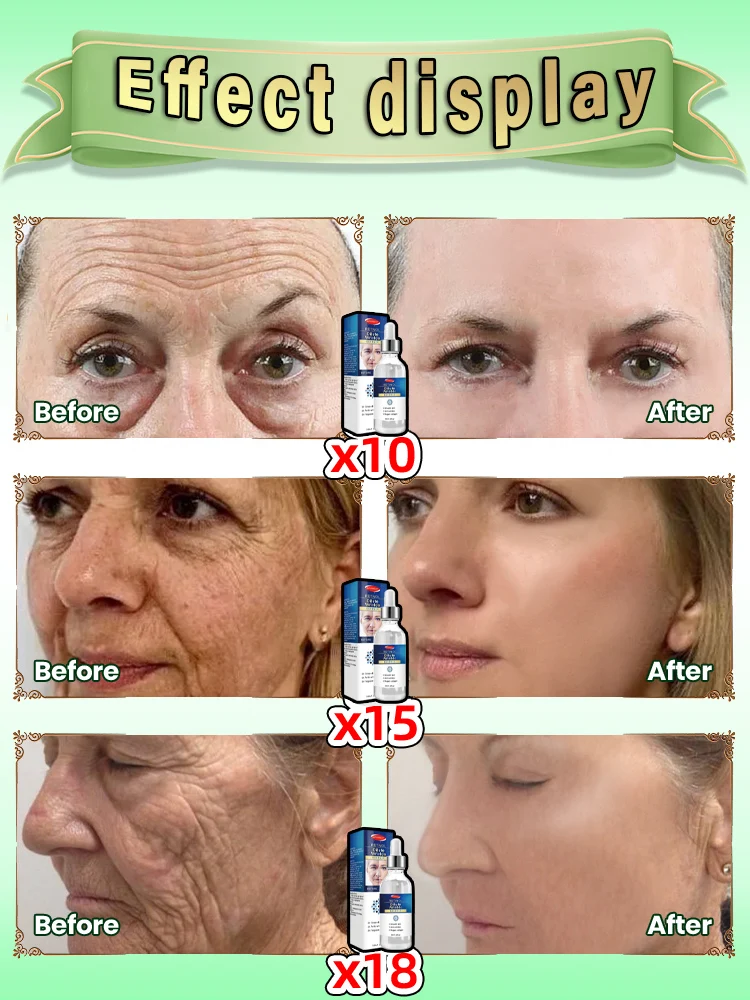 wrinkles disappear become beautiful now 4