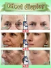 wrinkles disappear become beautiful now 4