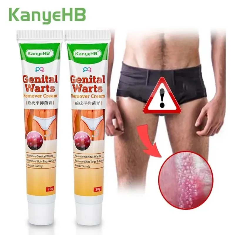 

KanyeHB средство для удаления бородавок мазь для гениталий вульвы гениталий герпес кондилома Acuminatum крем для лечения кожи