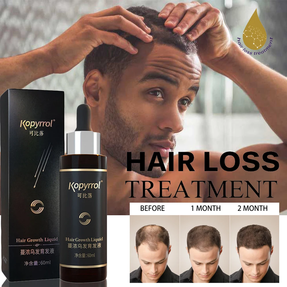 Hair Loss Treatment Hair/beard Growth Oil Hair Care Product For Men/women  Natural Plants Hair Serum Repair Damaged Hair Follicle - Hair Loss Product  Series - AliExpress