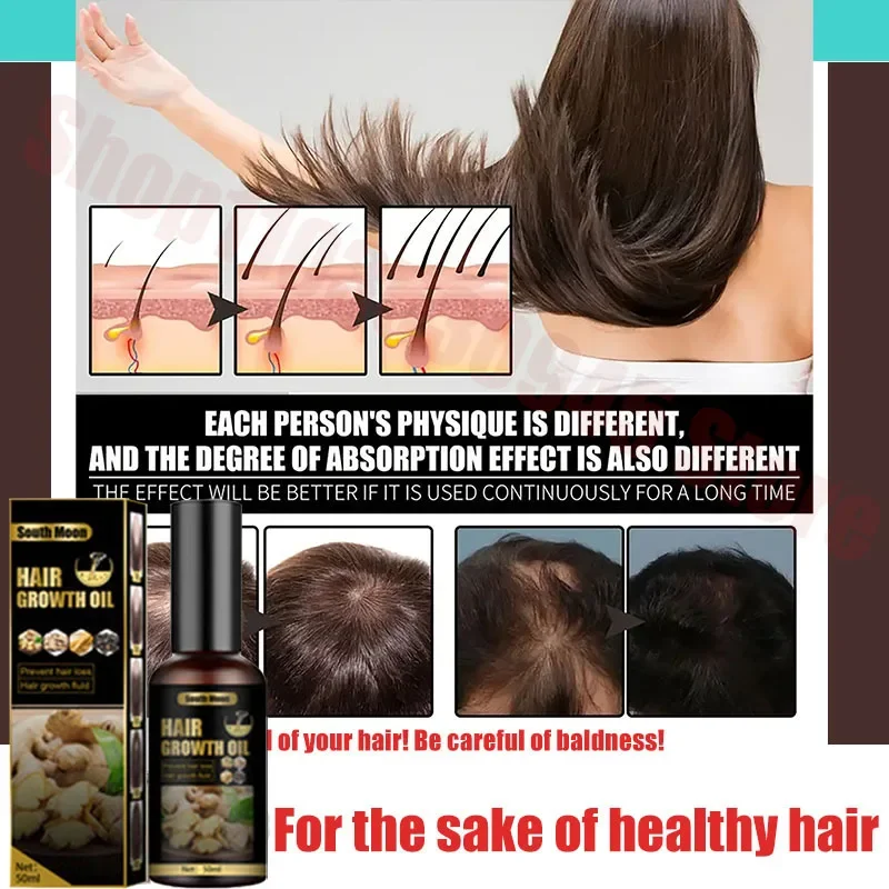 

Hair Growth Essential Oil Products Effective Fast Growing Serum Prevent Hair Loss Scalp Treatment for Men Women