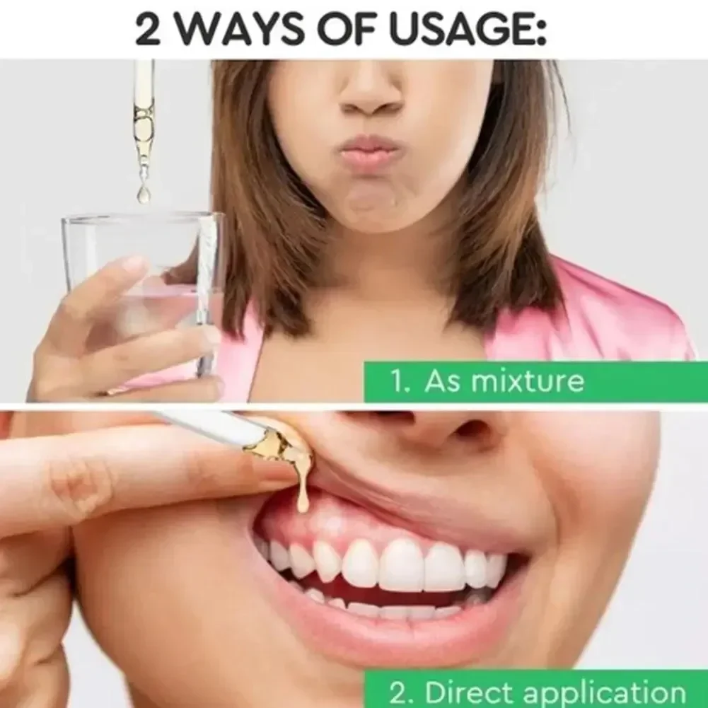 Gum Repair Drops Relieve Receding Gingival Swelling Gum Cleaning Care Oral Periodontal Hygiene Remove Yellow Tartar