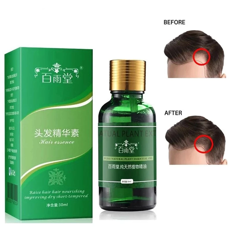 

Hair Care Hair Growth Essential Oils Essence Original Authentic 100% Hair Loss Liquid Health Care Beauty Dense Hair Growth Serum