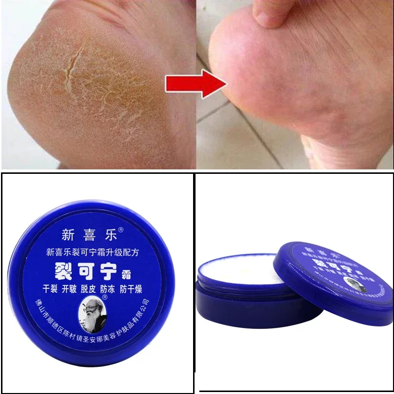 

Traditional Chinese 33g Oil Anti-Drying Crack Foot Cream Heel Cracked Repair Removal Dead Skin Hand Feet Care