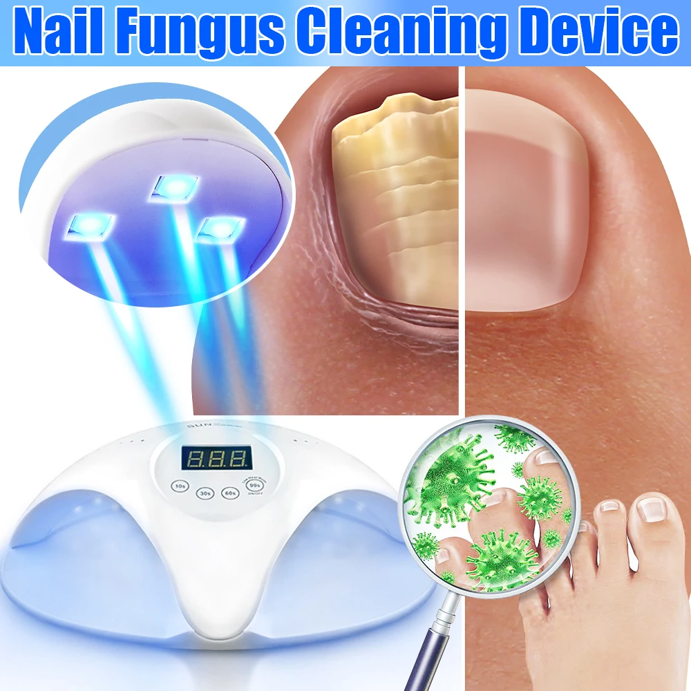 Electric Fungal Nail Laser Device Repair Fast Nails Fungus Onychomycosis Repair Toenail Fingernail Removes Nail Fungus Foot Care