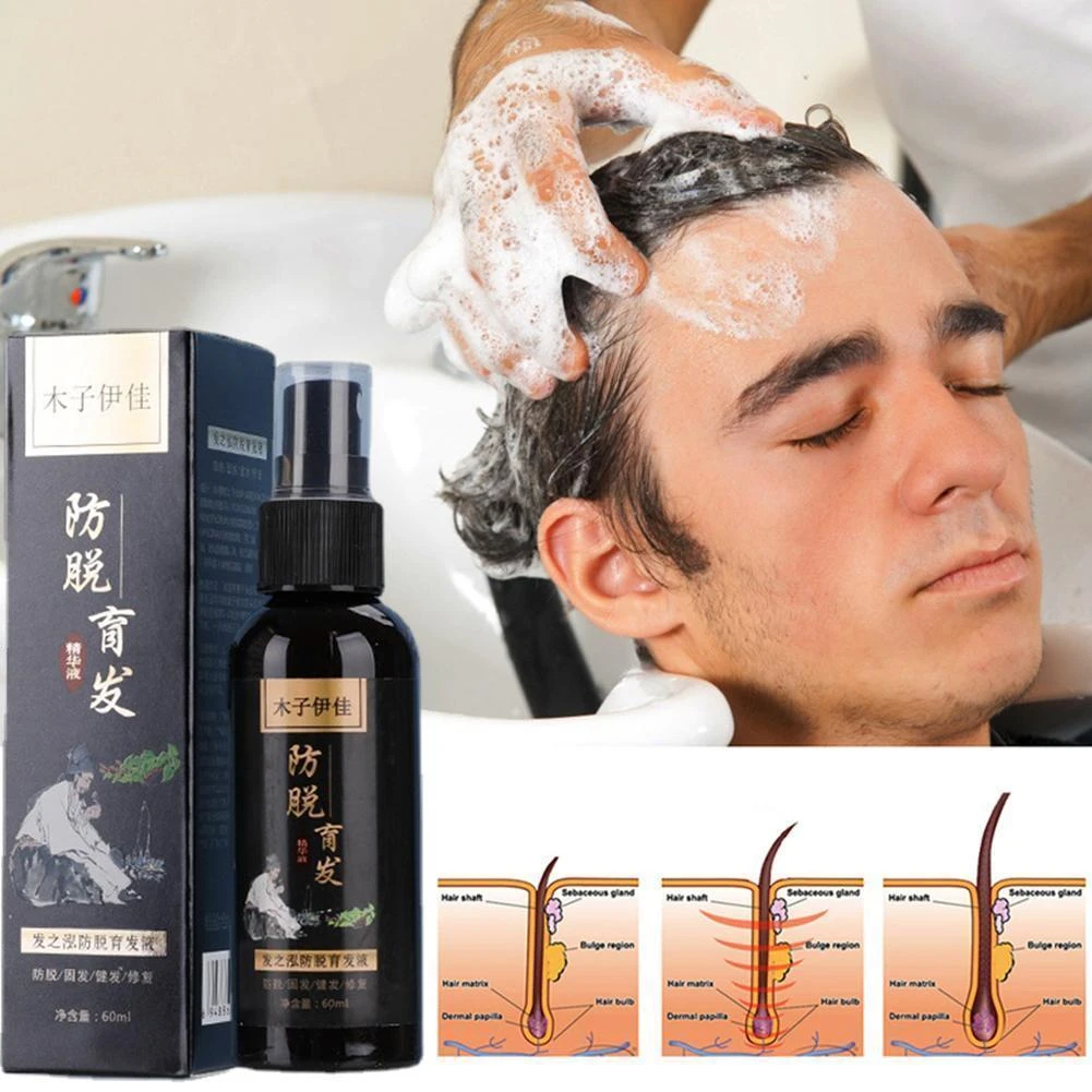 Herbal Hair Growth Products For Women Men Fast Growing Hair Serum Prevent  Hair Loss Oil Scalp Treatment Hair Care Beauty Tools - Hair Loss Product  Series - AliExpress
