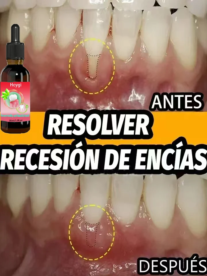 Whitening teeth quickly repair gums
