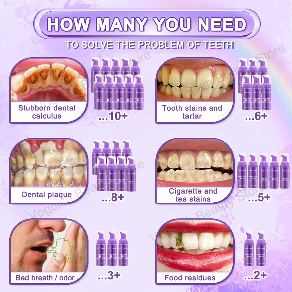 Рисунок 3 - Мусс для отбеливания зубов и ухода