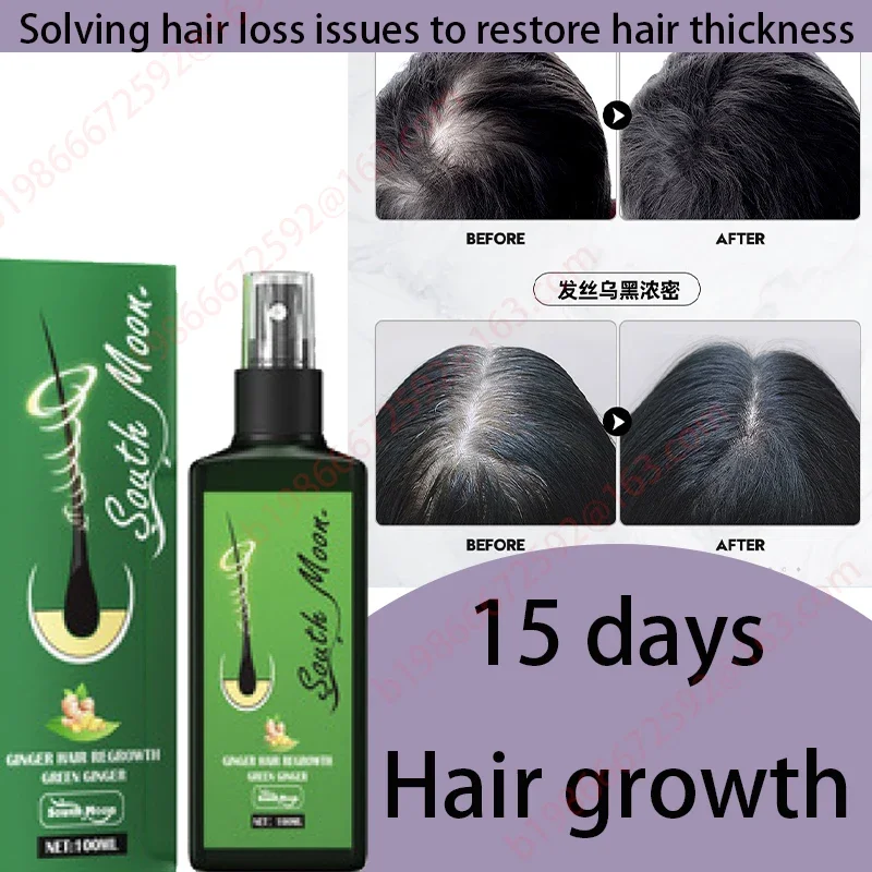 

Ginger Hair Growth Spray Serum For Anti Hair Loss Essential Oil Products Fast Treatment Prevent Hair Thinning Dry Frizzy Repair