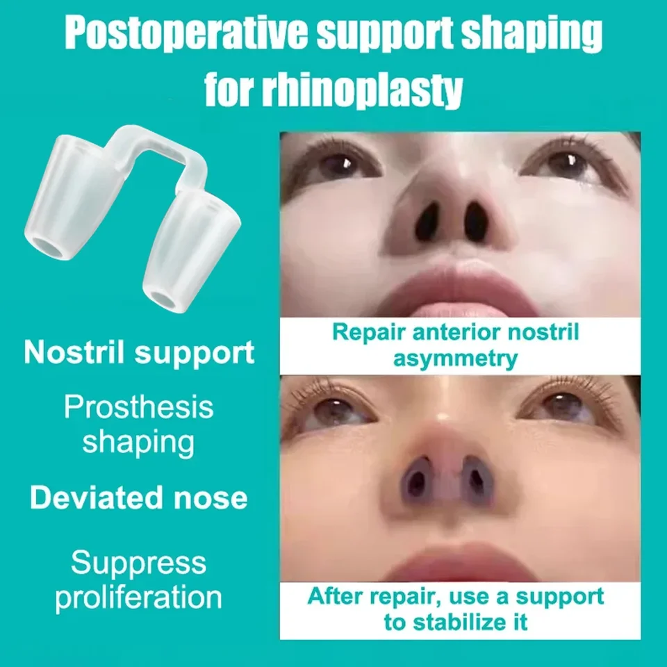 Nasal Dilator Silicone Postoperative Rhinoplasty Nostril Support