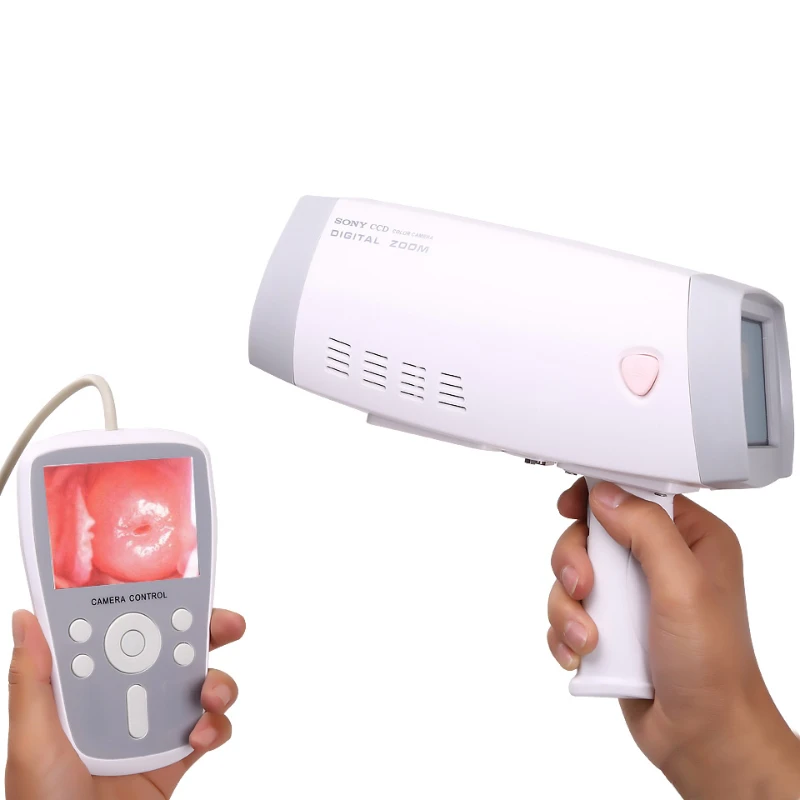 

HKN-2000 Handheld Digital Video for Gynecology