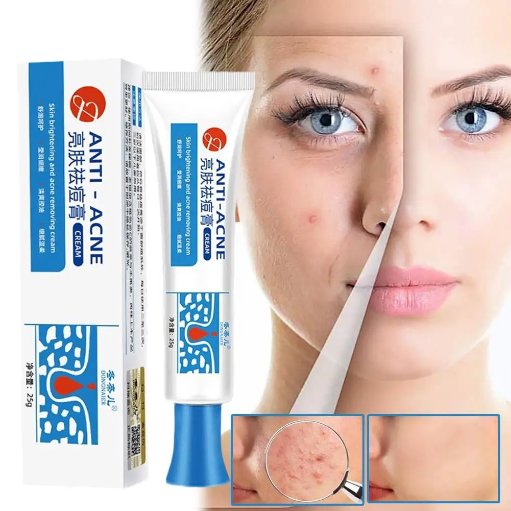 

Effective Acne Treatment Cream Anti Blackheads Acne Smooth Beauty Products Shrink Care Spots Skin Moisturizing Pores Bright U2W6