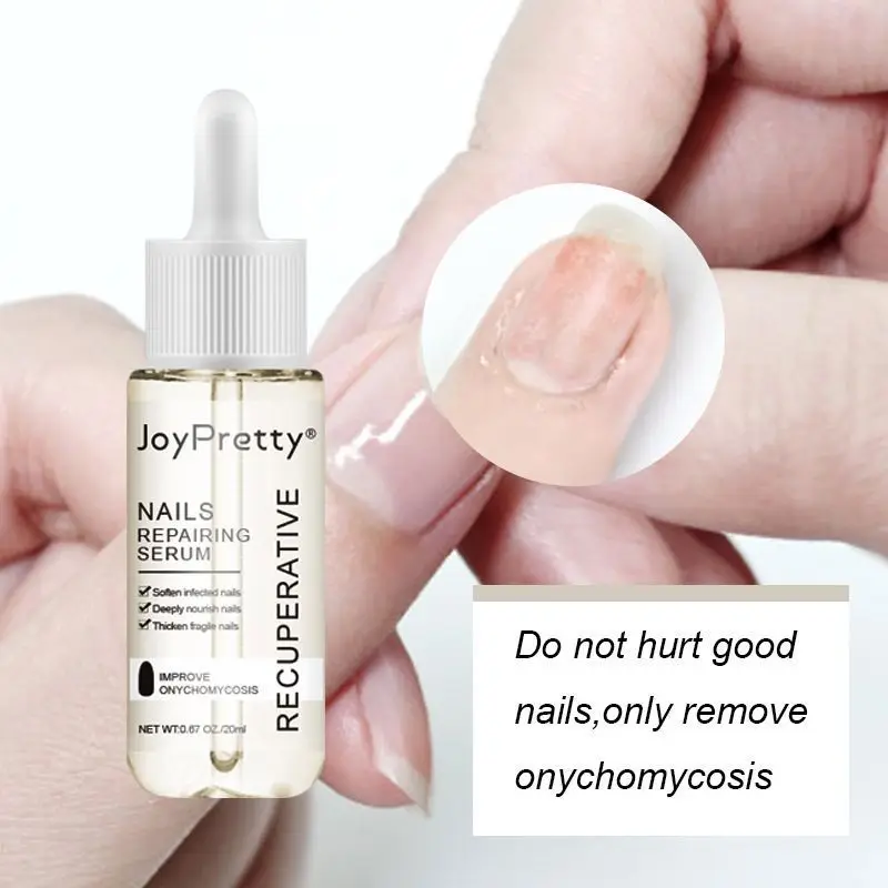 Nail fungus remover 20ml Nail Repairing Serum