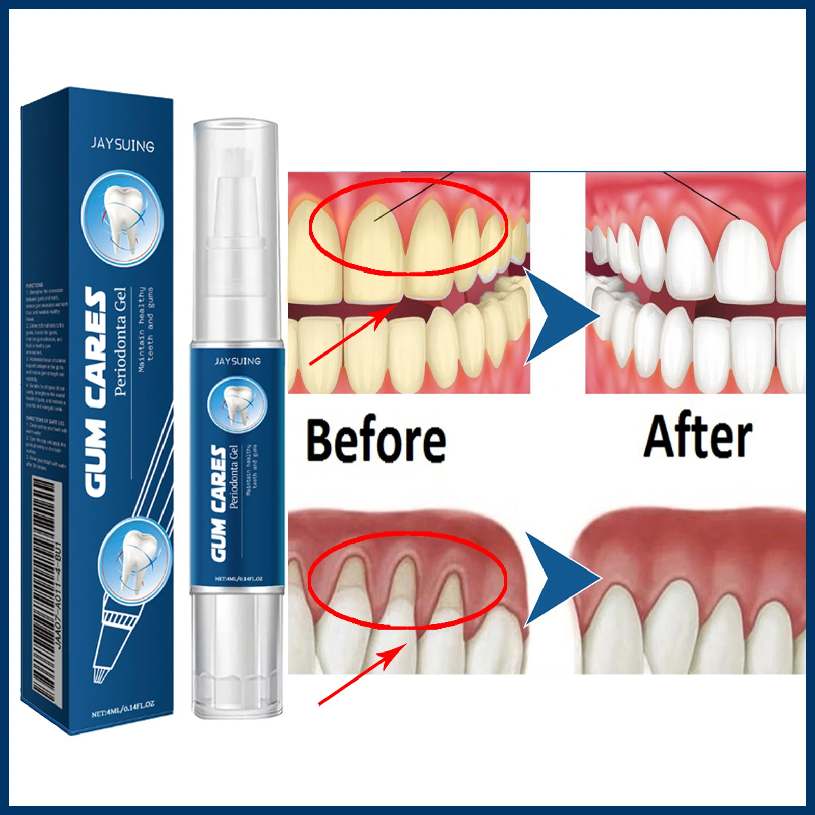Damaged Gum Repair Care Gel Relieves Sore Gums Allergies Deep Cleaning Stains, Tartar, Swollen Sore Gums Gum Cleansing Gel