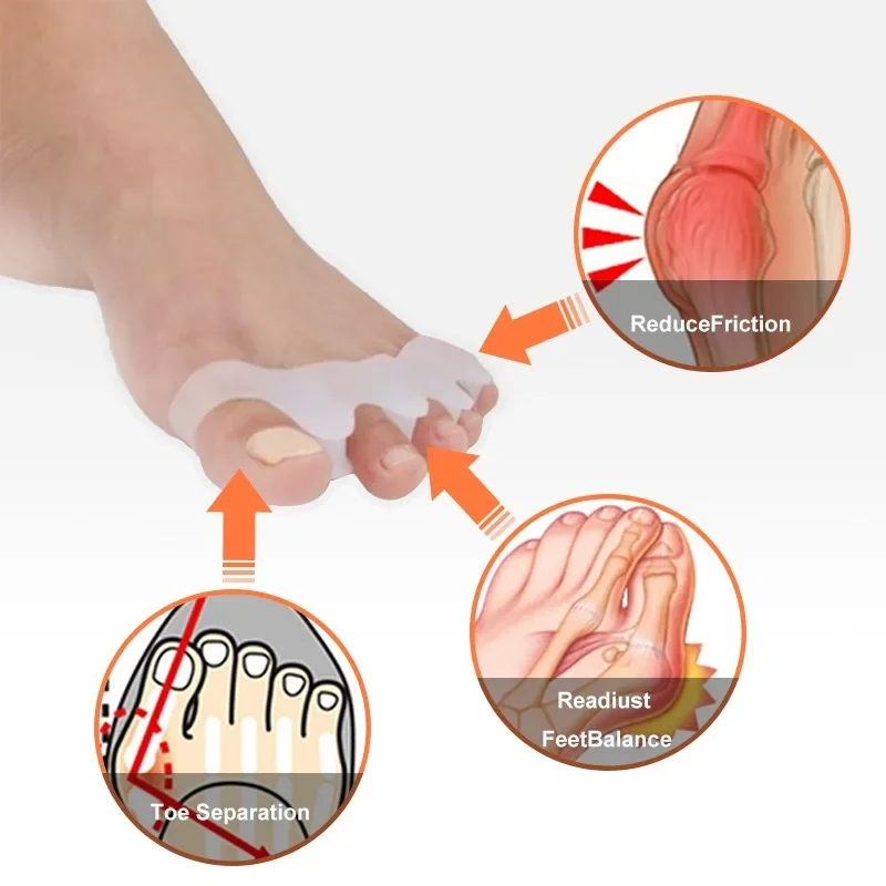 Toe Separators 2Pcs Toes Separator Hallux Valgus Bunion Corrector Soft Silicone Pedicure