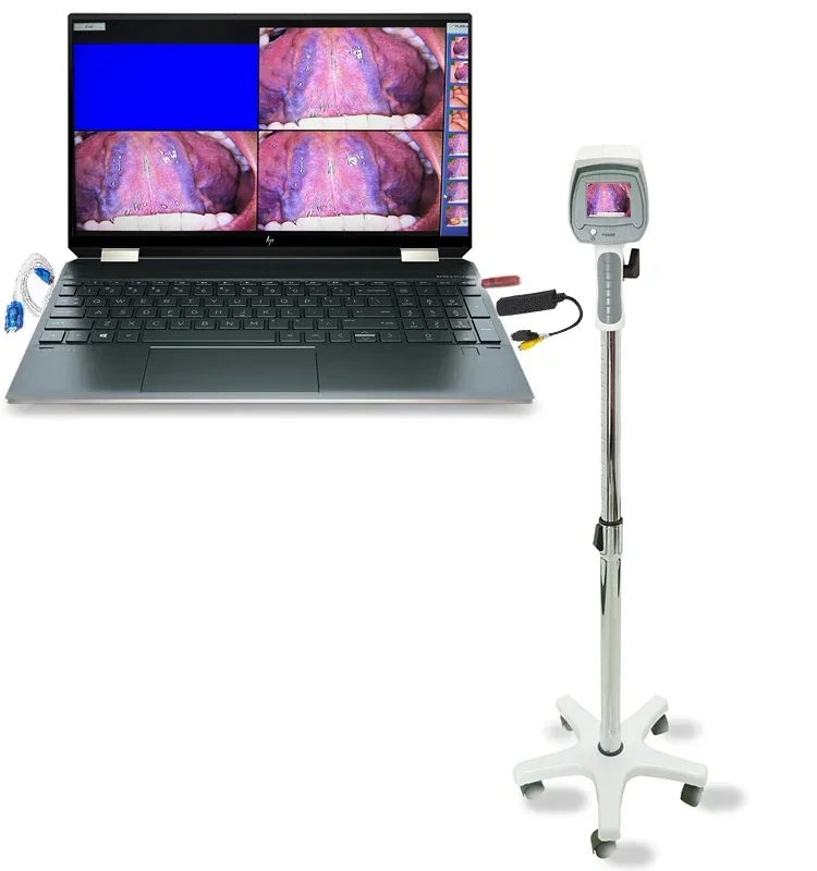

YYHC Good price medical gynecology equipment digital optical colposcope machine