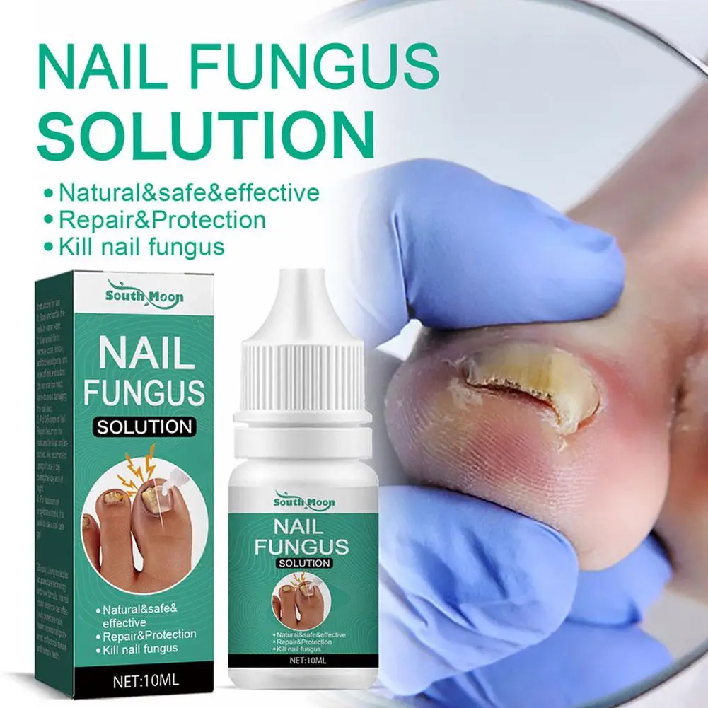 

Strong Nail Fungus Treatment Serum Essence Feet Removal Toe Care Serum Infection Nails Repa Essence Cream Fungal Anti M1s5