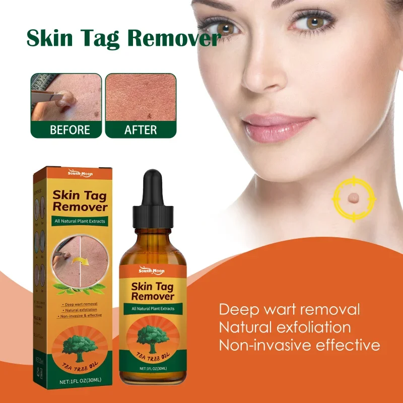 

Wart Removal liquid Body Warts Treatment essence Skin Tag traceless Remover Mole sharp Warts Chinese Herbal Medicine serum