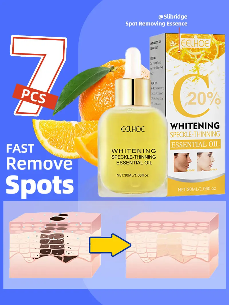 Lighten Freckles Melasma Dark Spots Face freckles dark spots remover