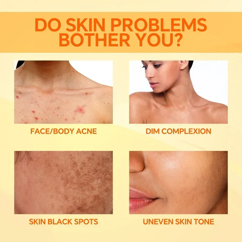 Kojic Acid Soap Skin Lightening Handmade Whitening Soap Bleaching exfoliating dilute acne Deep Cleaning Brighten Skin care