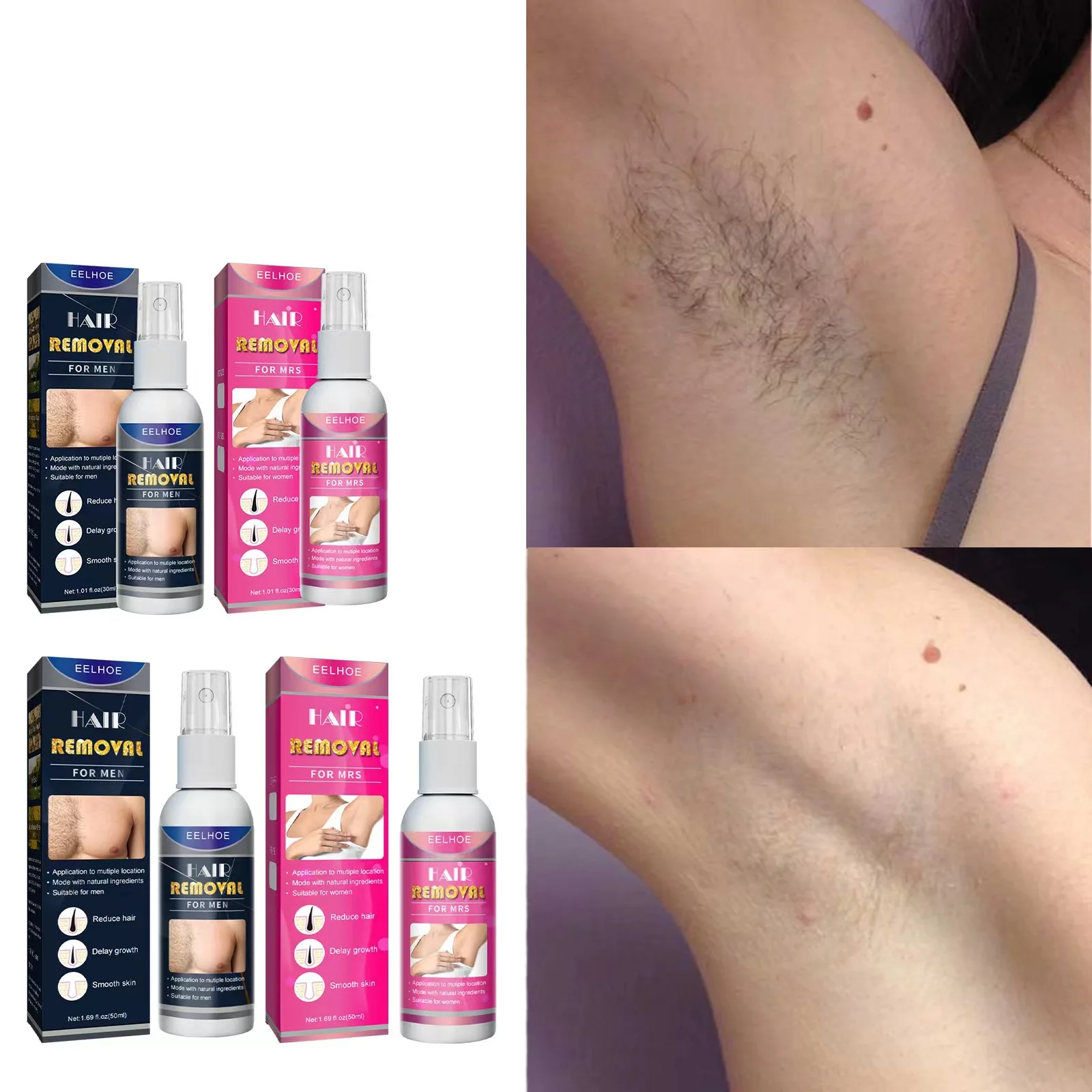 50 ml schmerzloses Haarentfernungsspray, Haarwachstumshemmer-Entferner, 100 % natürlich, permanentes Spray zur Entfernung von Gesicht, Arm, Achselhöhle, Bein, weiblich_voghion.com