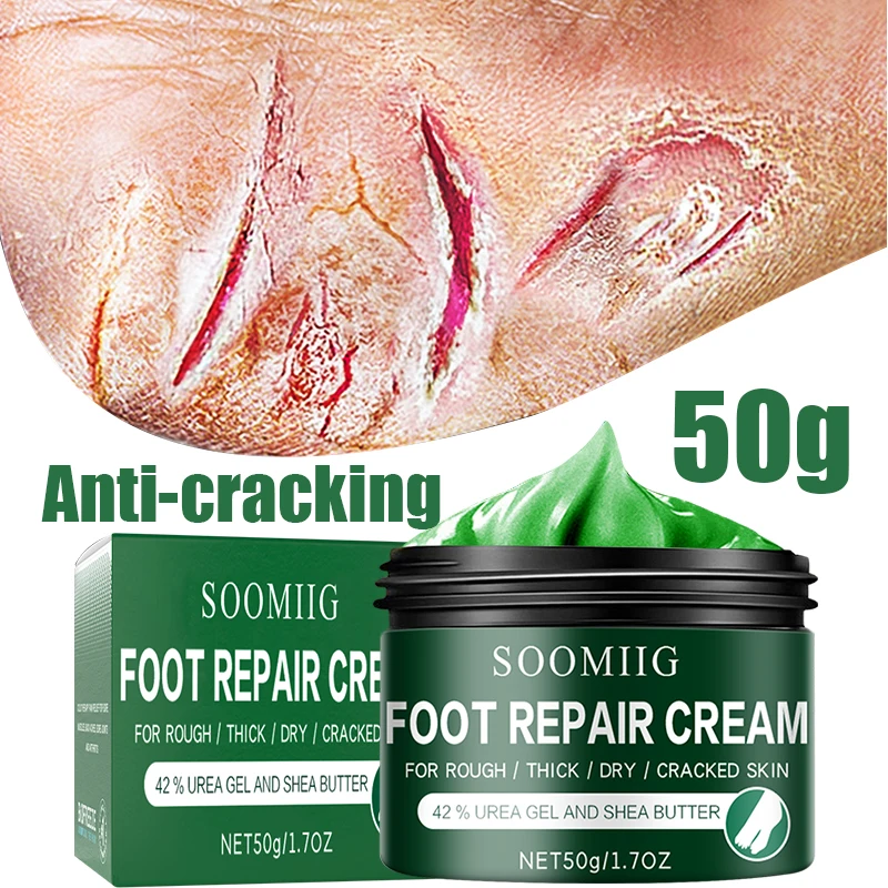Anti-Crack Effectively Repairs Hand  Foot Cracks Nourishing Anti-Crack Cream Treatment Dead Skin Care Crack Removal and Repair