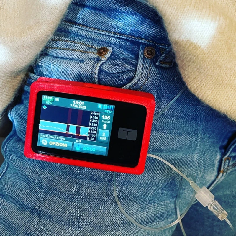Compatible Protective Shells for Tandem T:Slim X2/T:Slim Insulin Pumps